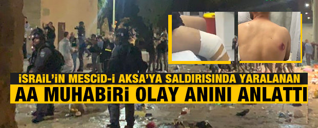 İsrail'in Mescid-i Aksa'ya saldırısında yaralanan AA muhabiri olay anını anlattı